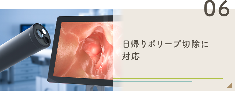 日帰りポリープ切除に対応